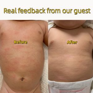 Baby Face Cream Smooth Skin Moisture Dry Skin 50g