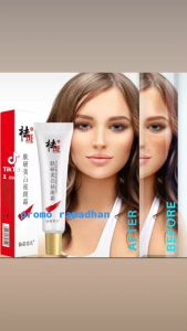 Cindynal Dark Spots: Penghilang Flek Hitam Membandel & Whitening Freckle Cream