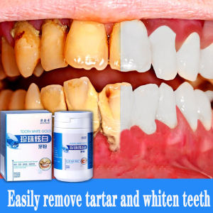 牙黄牙烟渍牙齿美白牙粉牙结石 Teeth tartar Ubat gigi pemutih Cleaning Dental Mouth calculus health pearl nafas berbau mulut white tooth powder