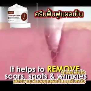 OUHOE ครีมซ่อมแซมรอยแผลเป็น การซ่อมแซมรอยแผลเป็นที่ผิวเบาการผ่าตัดคลอดครีมดูแลผิวรอยแผลเป็นจากการตั้งครรภ์