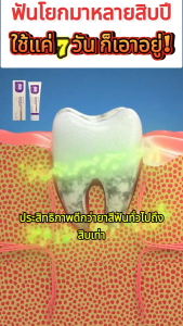 100g ฟอกสีฟัยาสีฟันโปรไบโอติกยาสีฟันฟันขาว ขจัดคราบฟัน แก้ฟันเหลือง ลดเหงือกอักเสบ ซื้อ 1 แถม 1 ลมหายใจสดชื่น ยาสีฟันไวท์เทนนิ่ง ยาสีฟันเบกกิ้งโซดา
