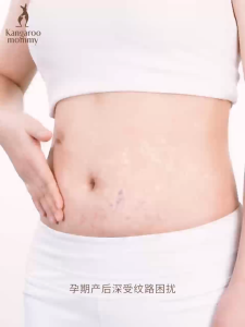 Kangaroo Mommy Firming & Repairing Wrinkle Body Lotion Repair Stretchmark Lotion 480g 袋鼠妈妈紧致修复皱纹抚纹霜 480g