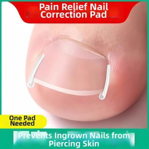Ingrown Toenail Correction Pad