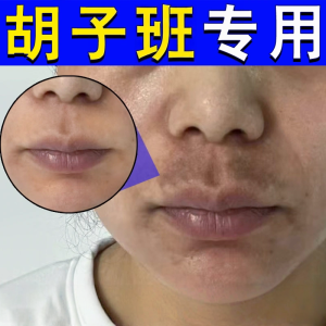 Remove Beard Spots and Improve the Precipitation of Melanin around the Lips Fade the Black and Dark Spots on the Corners of the Mouth Remove Dead Skin and Lip Lines Special Cream