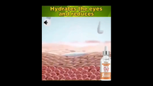 Fat granule remover 30ml 脂肪粒去除 Eye cream Eye removing magic device to remove fat particles Syringoma eye surrounding small granulation miliaria papule essence