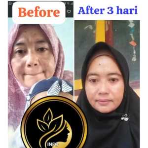 Salep pelicin wajah glowing Exspress by RG Beauty | Cream Wajah Glowing