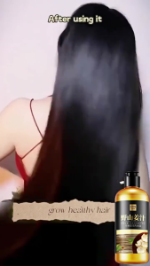 [100% Asli] Shampo Penumbuh Rambut Cepat Ginger Shampoo 300ml Botak Rontok Penumbuh Rambut Perawatan Hair Care Treatment Anti Rambut Rontok 300ML Anti Rambut Rontok Botak Ginger ShampooKontrol Minyak Menyegarkan Pelembab Nutrisi