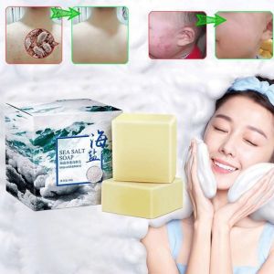 Sea Salt Face Wash: A Comprehensive Guide to Blackhead Removal & Acne Treatment