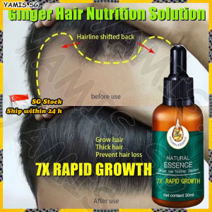 👒SG stock👒 Ginger hair growth serum / Fast hair growth essence / Anti hair loss serum / Hair loss treatment / Ginger hair tonic