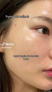 Cerave Hydrating Hyaluronic Acid Serum 30ml Hydrating Serum for Face with Vitamin B5 For Normal to Dry Skin Provides 24-hour hydration