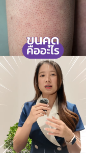 Kp-Clear ครีมดูแลอาการ ขนคุด โดยเฉพาะ kp clear 100มล 1ชิ้น