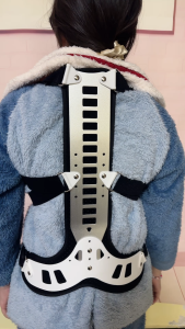 XS Size Kids Children Adjust Back Bad Posture Orthosis Brace Aluminum Plate Adjust Shoulder Waist Lumbar Spinal Humpback Orthopedic Strain Pain Relief Spine Support Corrector