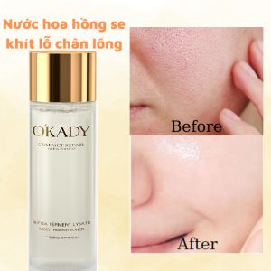 BIFIDA OKADY Toner Thu Nhỏ Lỗ Chân Lông Kiềm Dầu Cấp Nước Dưỡng Trắng Da Ngăn Ngừa Lão Hóa Giúp Da Mịn Màng Duy Trì Sự Trẻ Trung Cho Da