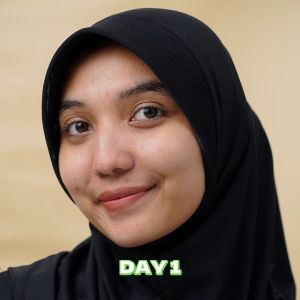 FOCALSKIN Acne-Care Clay Mask 7.5g | Salicylic Acid Masker Lumpur |  Gentle Natural Eksfoliasi / Penghilang Komedo Perawatan Jerawat Untuk Kulit Kombinasi Dermacare Untuk Kulit Berminyak - Lazada