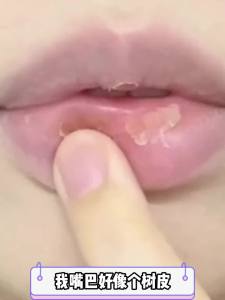 儒意维生素E润唇油淡化唇纹唇色去唇周黑防干裂修护保湿滋润唇膏