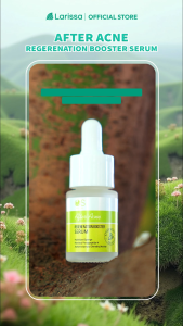 Larissa After Acne Regeneration Booster Serum - Serum wajah Untuk menyamarkan bekas jerawat