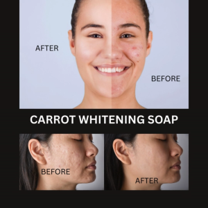 RESELLERS Package 126 Pieces of Carrot Whitening Soap 120g - Brightening Soap for Face and Body Anti-Dark Spots Melasma Acne Scars Natural Glowing Skin Bar Kojic Alternative Sabon Pampaputi for Filipina Skincare