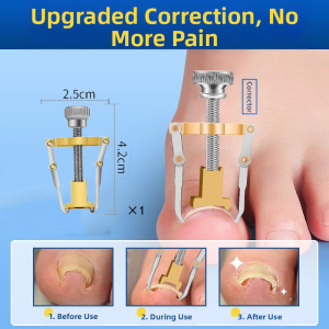 IMLUCKY | Ingrown Toenail Corrector Tool