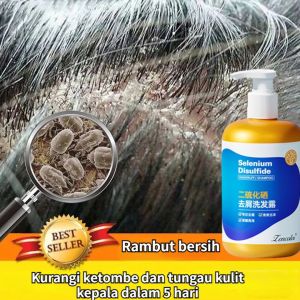 sampo kurap kulit kepala sampo anti ketombe sampo pengontrol minyak 300ml Shampo selenium disulfida Kulit Kepala Psoriasis Jamur Ketombe Kronis Anti Gatal Melembabkan Akar Rambut
