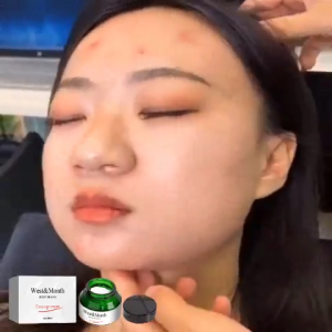 West&Month 30ml Hydrating Tinted Moisturizer with Collagen Hyaluronic Acid for Spot Acne Scar Coverage Brightening