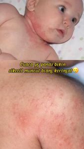Caladine Baby Liquid Powder 100gr / bedak / bubuk / cair / gatal gatal / iritasi / gigitan serangga / biduran/ gigitan nyamuk
