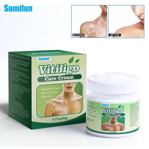 Sumifun White Spot Cream Herbal Antibacterial Cream Body Care 20g with Vitiligo Treatment Cream Original