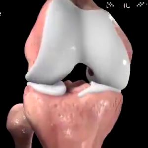 CTMALL 20g Pain Relief Cream: Natural Gel for Joint Health & Comfort