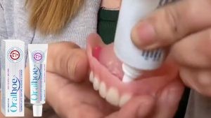 Oralhoe Comfort Denture Fixing Adhesive Keo nhựa mạnh mẽ Sản phẩm chăm sóc răng Keo nhựa nhiệt Bộ kem sửa răng