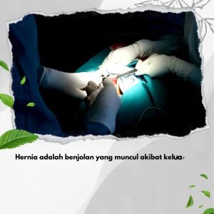 DEKAPRO BHARATA Asli: Obat Herbal untuk Hernia, Turun Berok, Verikokel & Usus Buntu