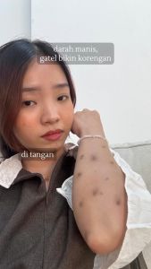 PROMO!!! EVOKE Moisturizing Body Wash 300ml - Pembersih Tubuh Untuk Kulit Gatal & Luka Basah