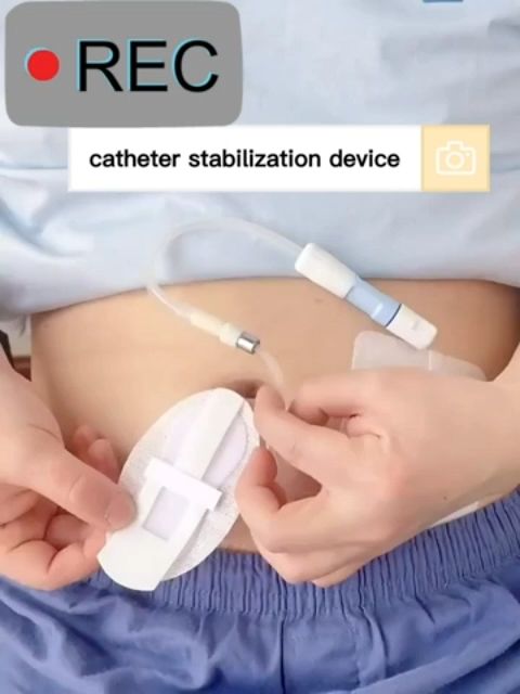 1pcs Medical PICC CVC Catheter Retainer with Disposable Catheter Stabilizing Fixture for Picc and Drainage Tube Fixtures Grip-Lok Medium Fixture Catheter Bag Holder for Gastric Feeding Tubes