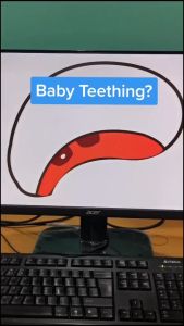 Tiny Buds First Tooth Natural Baby Teething Gel (20g)