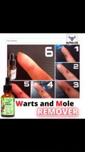 Pure 100% Kasoy OIL for Warts Mole Remover 15ml with dropper for Butlig Kulugo Nunal An-An 1pc.