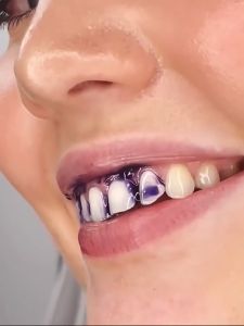 v34 Purple colour corrector hismile Teeth Whitening Toothpaste my smile Toothpaste serum kit Against Sensitive tooth ubat gigi pemutih gigi putih tartar remover fresh breath 30ml 美白牙膏