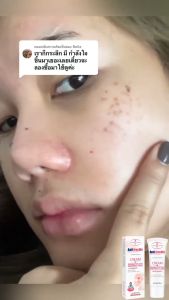 🎉ของแท้🎉 ครีมลดเลือนจุดด่างดำ ครีมบำรุงผิวหน้า ลดเลือนจุดด่างดำ ลดเลือนสีผิว ให้ความชุ่มชื้นและเติมน้ำให้ผิว ลดความหมองคล้ำ ป้องกันจุดด่างดำ เช่น ฝ้า กระ ลดเลือนจุดด่างดำอย่างรวดเร็ว ขนาด 20 กรัม