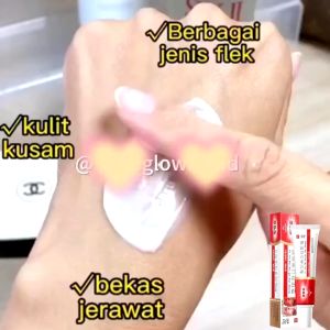 🔥 Whitening Freckle Cream 20g Salep Krim Penghilang Flek Hitam di Wajah Penghilangkan Bintik Gelap Anti Bintik Niacinamide Memudar Pigmentasi Melasma Dan Mencerahkan Krim