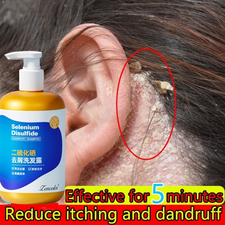 【Malaysia delivery】anti dandruff shampoo 300ml dandruff itching oil