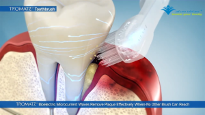 Bàn Chải Đánh Răng Điện Sinh Học Great Gums One - Công Nghệ Vi Dòng Điện Làm Sạch Mảng Bám Dịu Nhẹ Nướu Nhạy Cảm