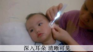 Dụng Cụ Lấy Ráy Tai- Có Đèn Cho Bé Yêu - Siêu Tiện Lợi
