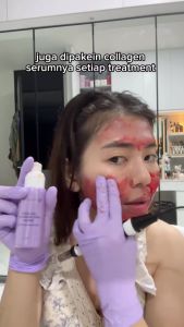 Bundling Collagen Pore Minimizer Serum + Collagen Zinc Gentle Wash