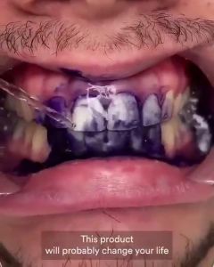 hismile v34 colour corrector Purple Teeth Whitening Tooth Stain  Purple Toothpaste smile kit Against Sensitive