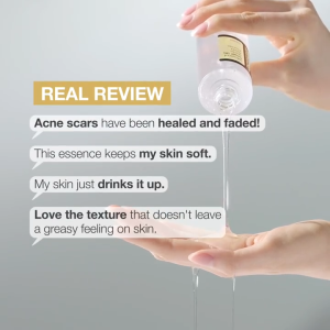 Advanced Snail 96 Mucin Power Essence 100ml Snail Secretion Filtrate 96.3% for Anti-aging & Nourishing