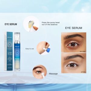 Lakerain 5% Caffeine Eye Serum Puffy Eyes Treatment Under Eye Roller Cream for Dark Circles and Puffiness with 360° Massage Ball Reduce Wrinkles and Fine Lines Bags under eyes