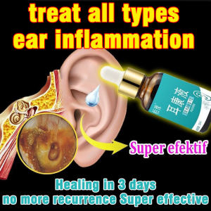 Natural Chinese herbal Tinnitus relief ear drops Earwax Cleaner Liquid ear wax softener ear pain medicine medicine without pain ear cleaning tool Ear Wax RemovalCleaner Itchy earstinnitusear wax for adults and childrenReduce discharge infection