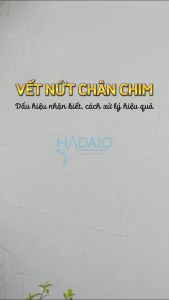Sika Trám Khe Nứt - Combo Sikadur 20 Crack Seal (160ml) và keo chà ron Sikaceram 608 Tile Grout (1kg trắng)