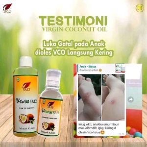 VICO OIL SR12 MINYAK KELAPA ASLI/SERBAGUNA