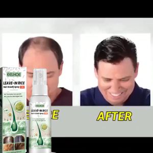 Semprotan penumbuh Rambut 100ml Obat Penumbuh Rambut Botak Perawatan/Pria penumbuh rambut cepat dan teba