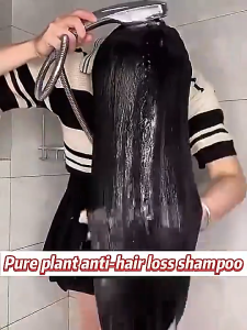 Penumbuh Rambut Cepat Ginger Shampoo Rambut Rontok Anti Rambut Sampo Pemanjang Rambut 500ml Shampo Jahe Perawatan Rambut Rontok Memperkuat Akar Rambut Penumbuh Rambut Cepat dan Tebal Pengendalian Minyak