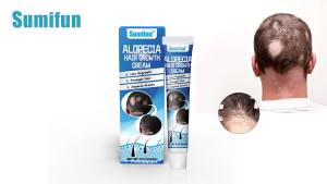 Sumifun Alopecia Areata cream Gentle formula hair development care cream Promote hair follicle growth Health care ointment Scalp care Herbal cream 20g