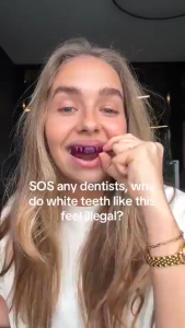 【Upgraded Version】SmilekIt V34 Purple Teeth Whitening Strips for Sensitive Teeth Fast Results in 7 Days Whiten Your Smile Naturally